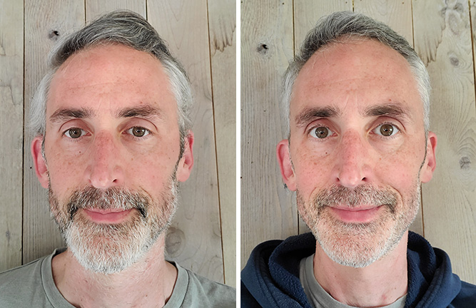 photos showing the author ethan green's face before and after giving up sugar and alcohol, taken one month apart.